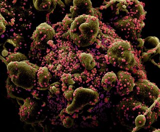 Colorized scanning electron micrograph of an apoptotic cell (greenish brown) heavily infected with SARS-COV-2 virus particles (pink), also known as novel coronavirus, isolated from a patient sample. Image captured and color-enhanced at the NIAID Integrate