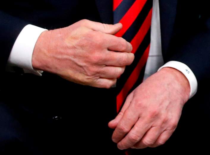 The imprint of French President Emmanuel Macron's thumb can be seen across the back of U.S. President Donald Trump's hand after they shook hands during a bilateral meeting at the G7 Summit in in Charlevoix, Quebec, Canada, June 8, 2018.