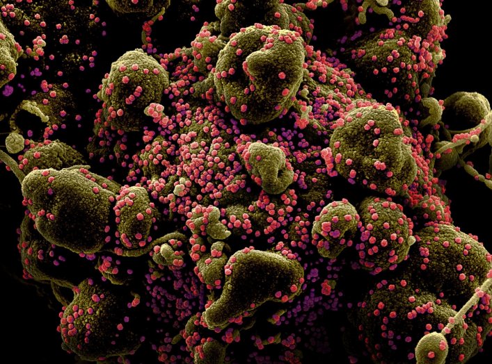 Colorized scanning electron micrograph of an apoptotic cell (greenish brown) heavily infected with SARS-COV-2 virus particles (pink), also known as novel coronavirus, isolated from a patient sample. Image captured and color-enhanced at the NIAID Integrate
