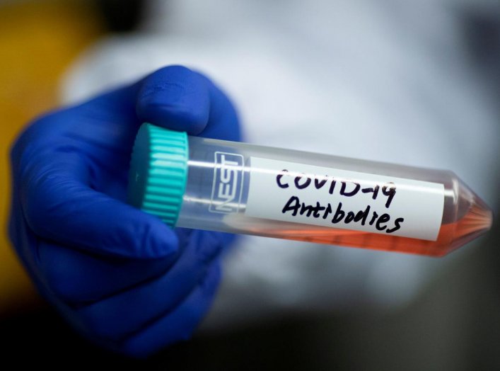 Scientist Linqi Zhang shows a tube with a solution containing COVID-19 antibodies in his lab where he works on research into novel coronavirus disease (COVID-19) antibodies for possible use in a drug at Tsinghua University's Research Center for Public Hea